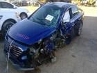 Passenger Quarter Panel Vin 2 5TH Digit Fits 15 Sonata 578718 Used. Price: $415.19.